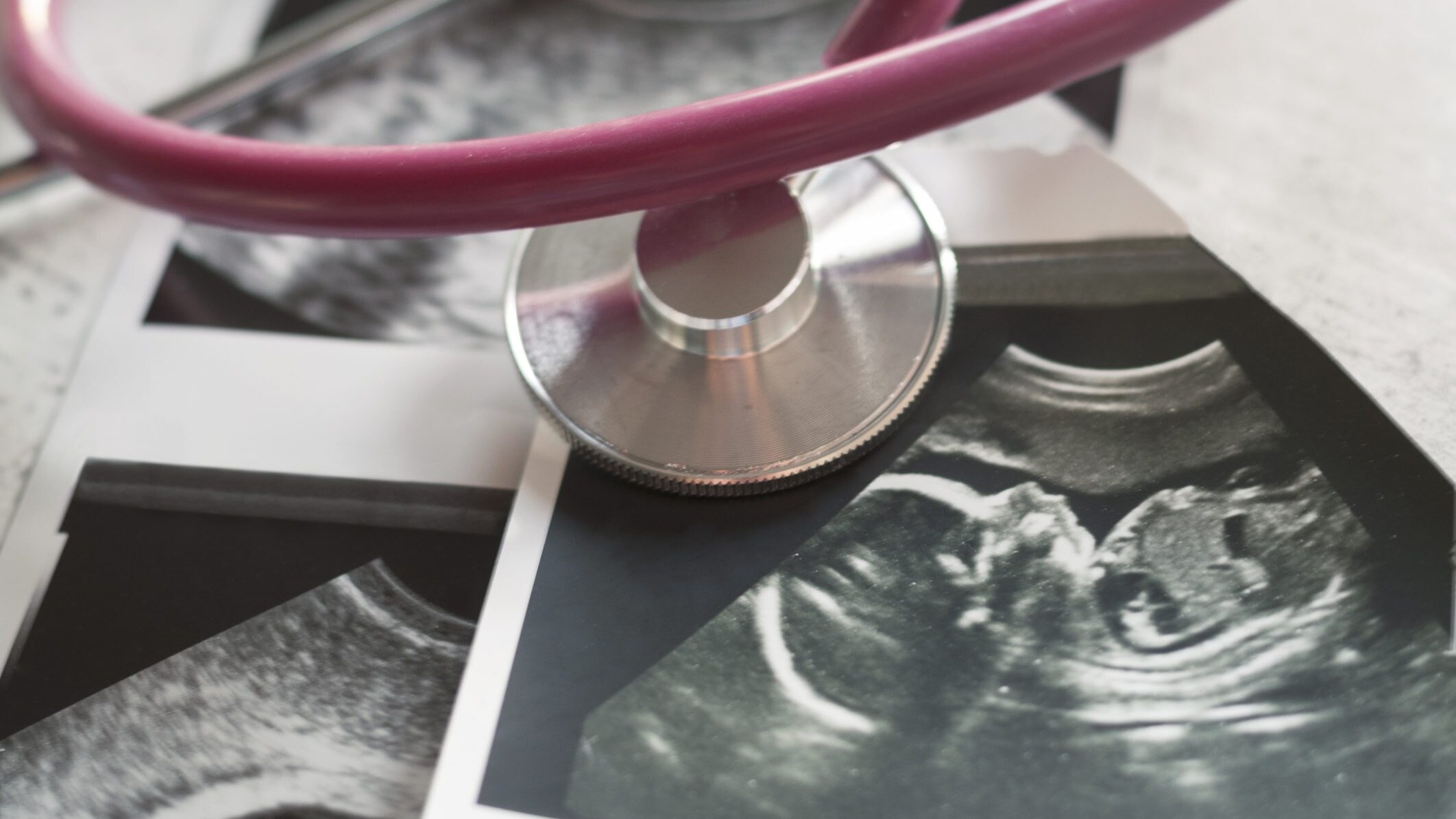 14esima settimana di gravidanza