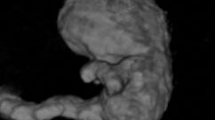 Feto ologramma 3D