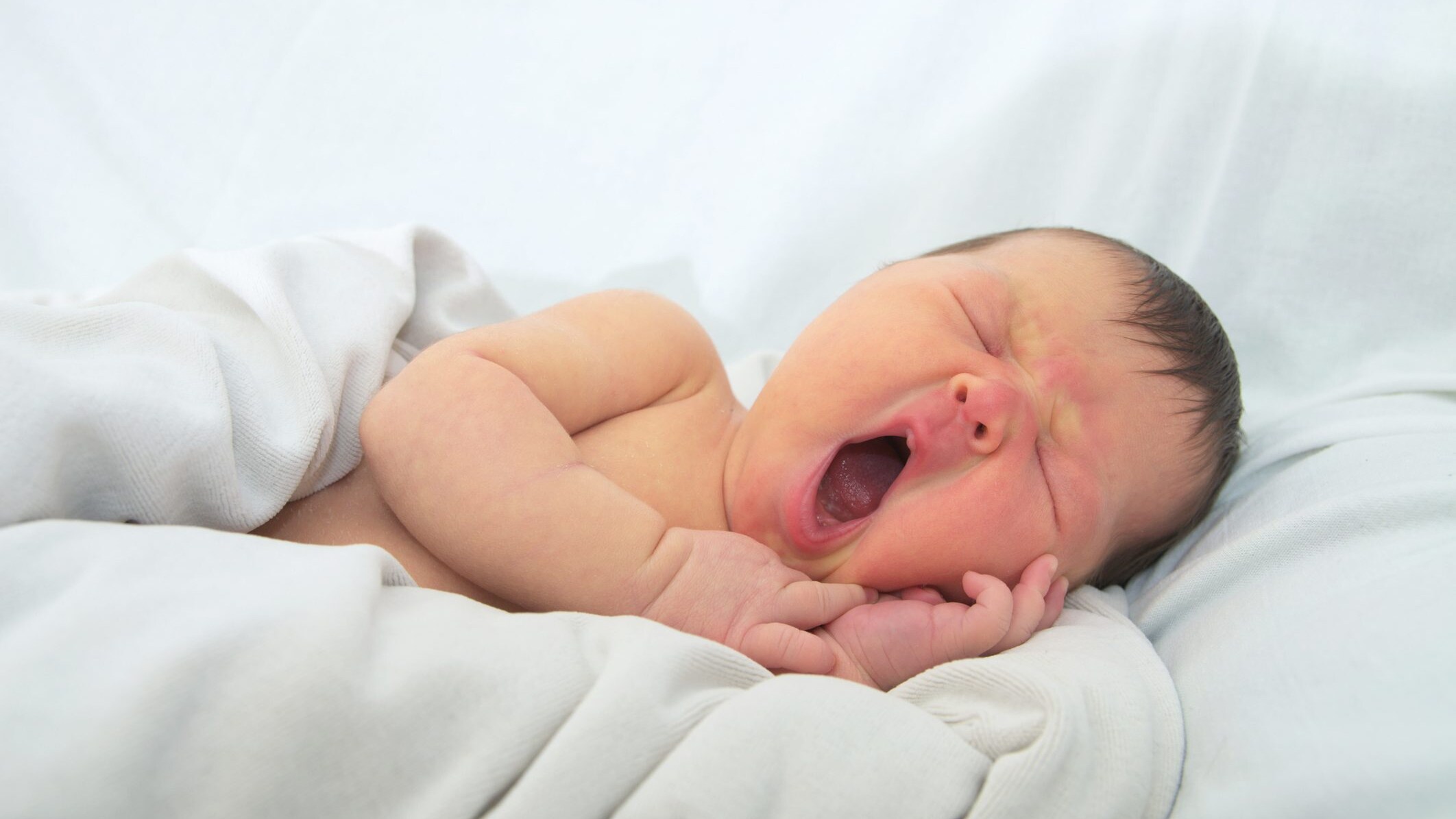 ittero neonatale