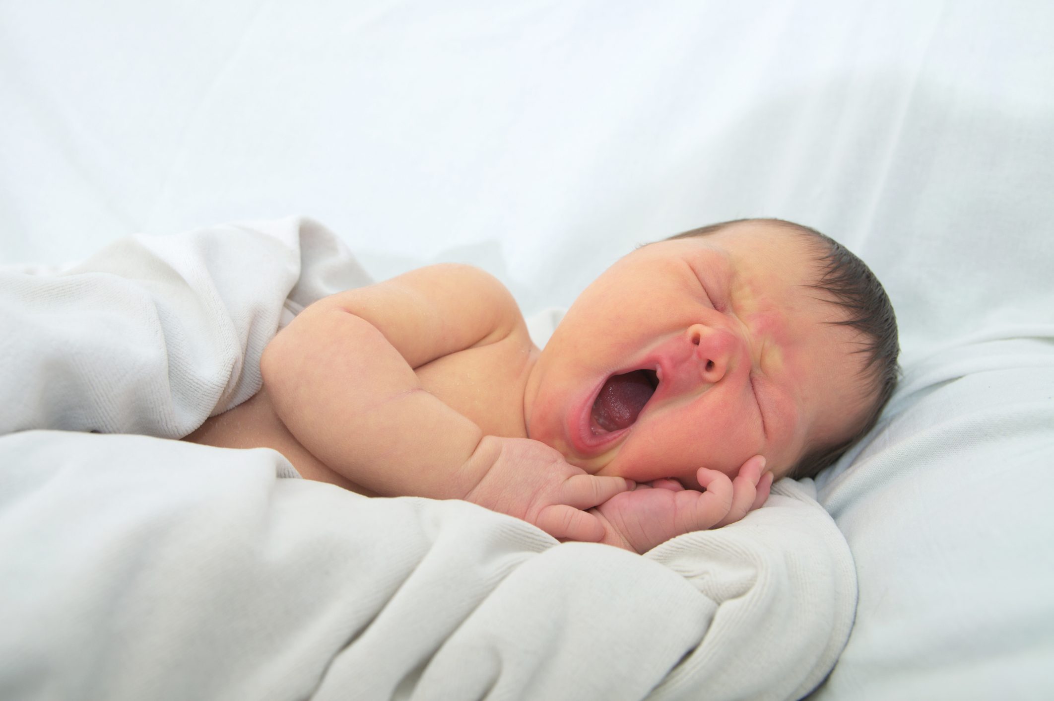 ittero neonatale