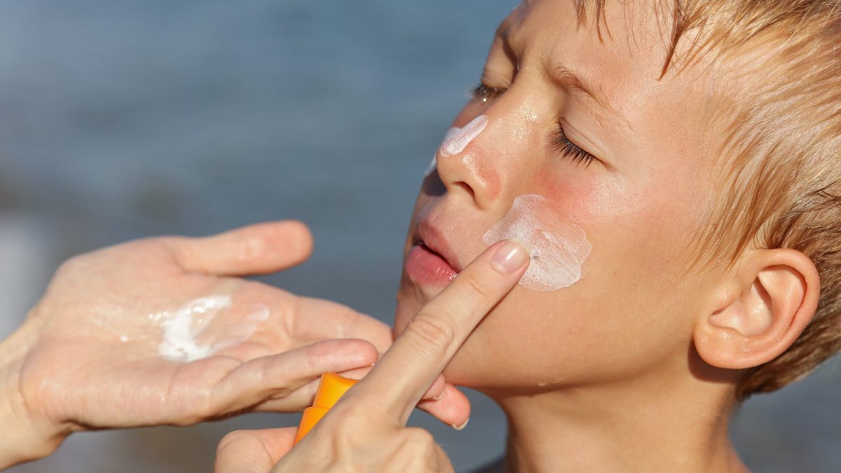 macchie solari bambini