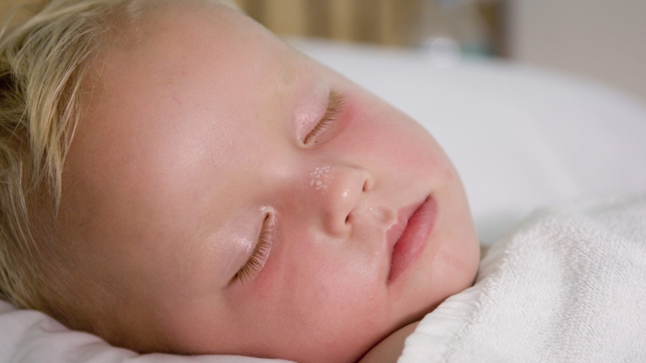 sudorazione bambino
