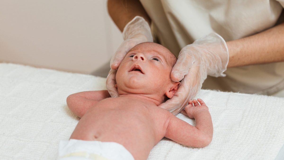 plagiocefalia osteopata