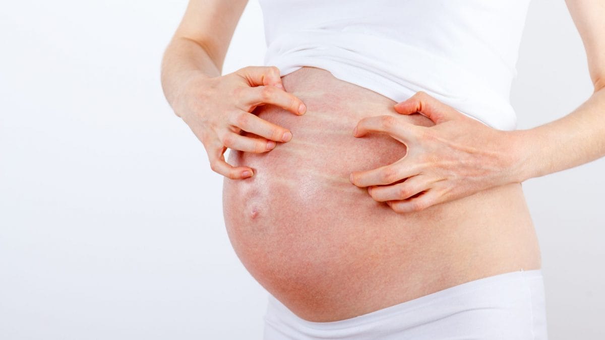 rosolia in gravidanza